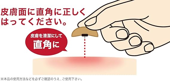 祐徳薬品工業 スポールバン(管理医療機器)30本を、皮膚面に直角に正しくはってください。